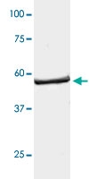 PAB12774 - LCK