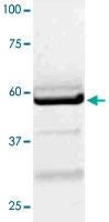 PAB12775 - LCK