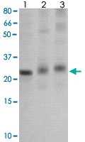 PAB12778 - SOCS1