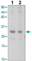 PAB12779 - SOCS2 / CIS2