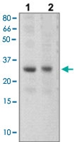 PAB12780 - SOCS3 / CIS3