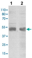 PAB12781 - SOCS4