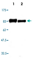 PAB12794 - PRKCE