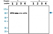 PAB12803 - RAF1