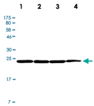 PAB12805 - UCHL1 / PGP9.5