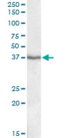 PAB12817 - PON1