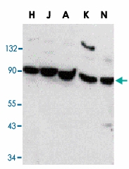 PAB12820 - STAT1