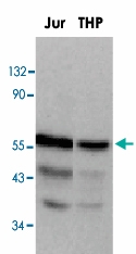 PAB12821 - DOK1 / p62 dok