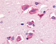 PAB12822 - CD253 / TRAIL