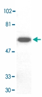 PAB12829 - DAXX