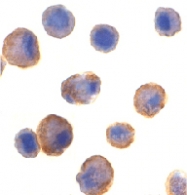 PAB12830 - CD262 / TRAILR2