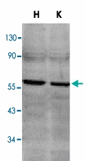 PAB12830 - CD262 / TRAILR2
