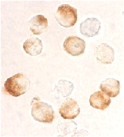 PAB12836 - IKBKB / IKKB