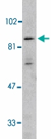PAB12836 - IKBKB / IKKB