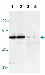 PAB12839 - TNFRSF21 / Death receptor 6 (DR6)