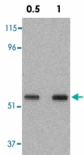 PAB12845 - SKIL / SnoN