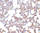 PAB12845 - SKIL / SnoN