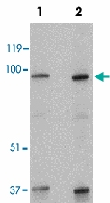 PAB12846 - SKI