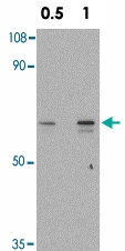 PAB12847 - SKIP