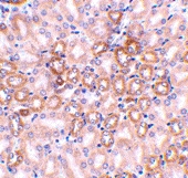 PAB12848 - Nephrin