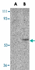 PAB12849 - FAIM3 / TOSO