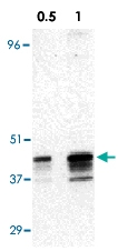 PAB12860 - RRM2B / P53R2