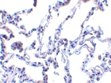 PAB12860 - RRM2B / P53R2
