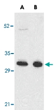 PAB12862 - CD267 / TACI