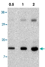 PAB12863 - NOXA