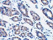 PAB12863 - NOXA
