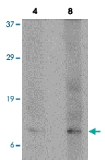 PAB12865 - TP53AIP1