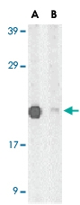 PAB12866 - PERP