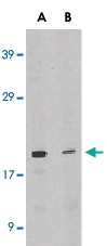 PAB12867 - Interleukin-21 / IL21
