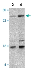 PAB12869 - NKIRAS1