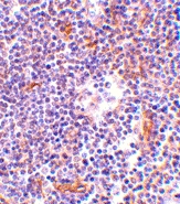 PAB12869 - NKIRAS1