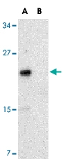 PAB12871 - NKIRAS2