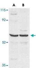 PAB12874 - CARD9