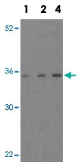 PAB12876 - MOAP1