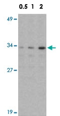 PAB12877 - NDEL