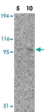 PAB12878 - CARD10