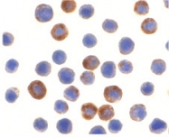 PAB12880 - BIRC8 / ILP2