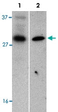 PAB12880 - BIRC8 / ILP2