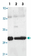 PAB12882 - Septin-4 (SEPT4)