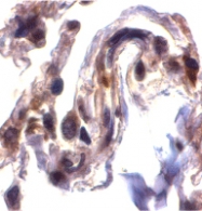 PAB12882 - Septin-4 (SEPT4)
