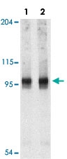 PAB12883 - NALP2