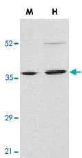 PAB12884 - Endonuclease G