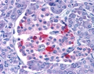 PAB12884 - Endonuclease G