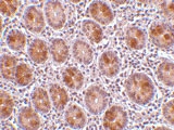 PAB12886 - AATF