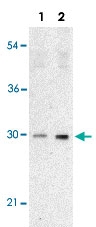 PAB12887 - TP53INP1