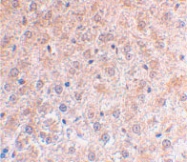PAB12887 - TP53INP1